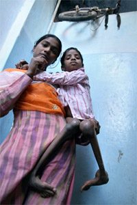 bhopal-victims