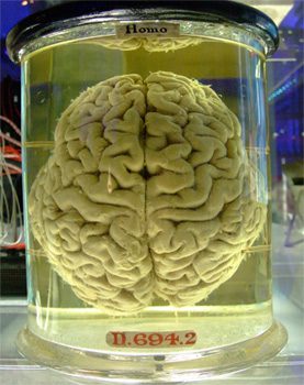 brain-jar