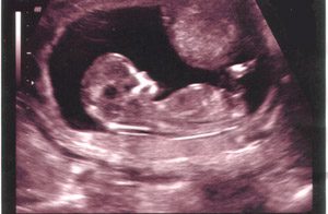 developing-fetus