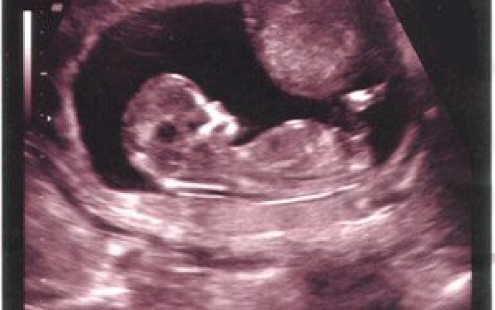 developing-fetus
