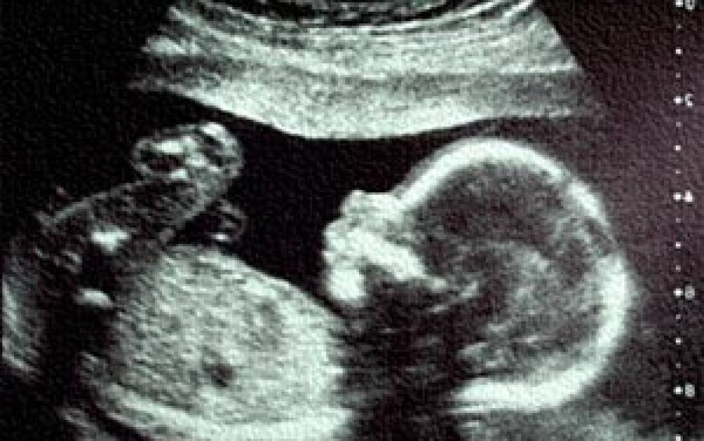 fetus-in-womb